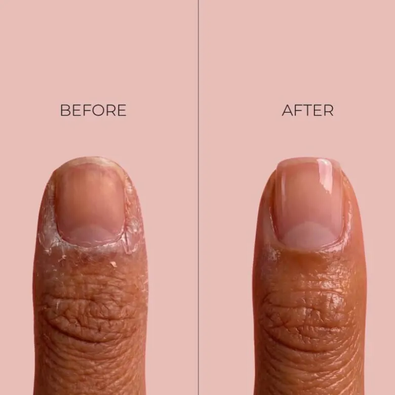 Huile sèche nourrissante ongles et cuticules – réparation, renforcement / 11ml