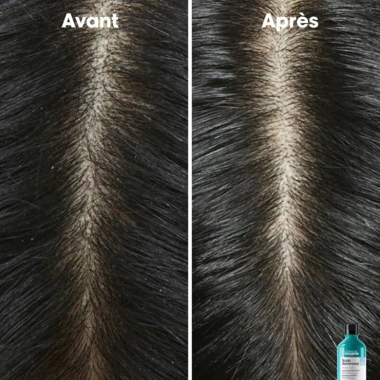 Shampoing dermo-clarifiant anti-pelliculaire Scalp Advanced / 500ml