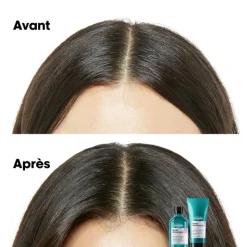 Shampoing dermo-régulateur apaisant Scalp Advanced / 1500ml