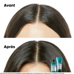 Traitement apaisant intense Scalp Advanced / 200ml