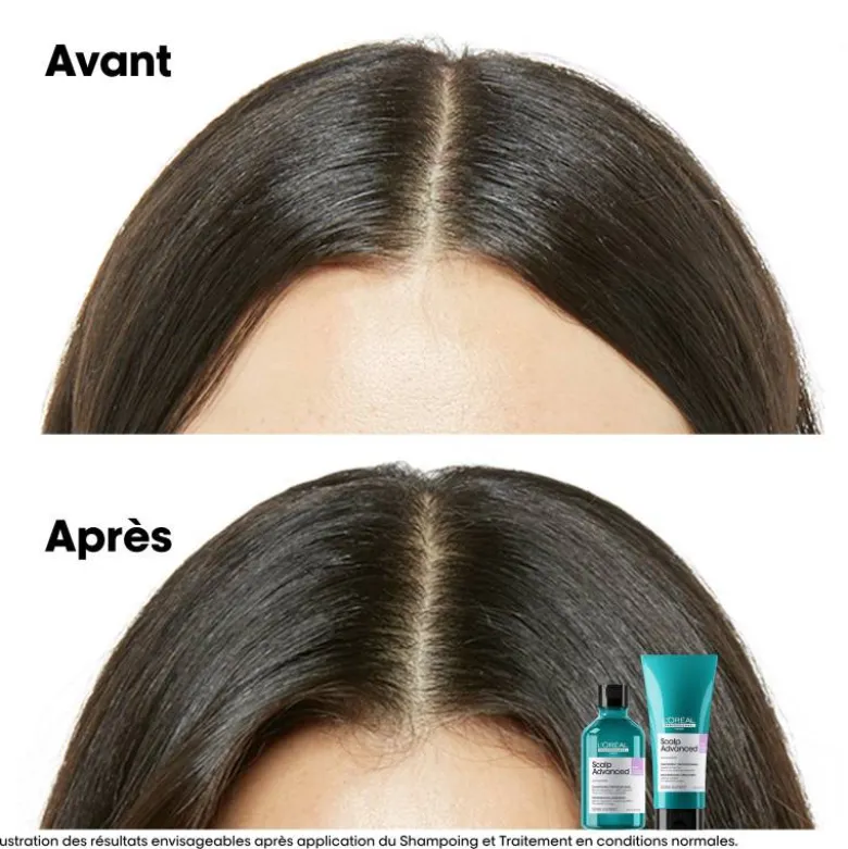 Traitement apaisant intense Scalp Advanced / 200ml